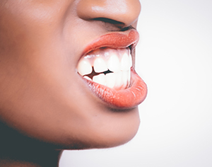 השתלת שיניים ביום אחד – כל מה שצריך לדעת