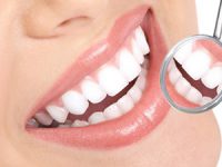 איך הפכה הלבנת השיניים לכל כך פופולרית?