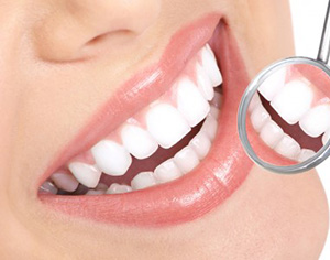 איך הפכה הלבנת השיניים לכל כך פופולרית?