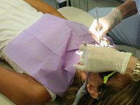 שיטות חדשניות ליישור שיניים למבוגרים
